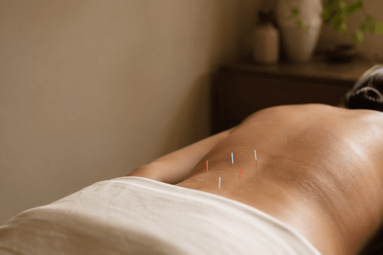 Close-up of fine acupuncture needles placed along a patient's lower back during a treatment session, with warm natural light