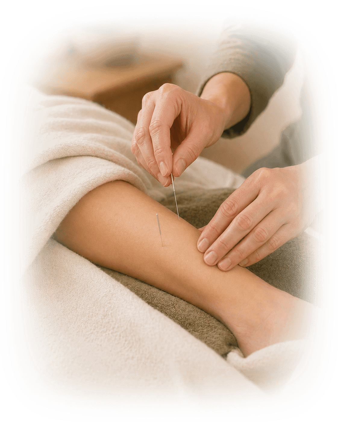 Practitioner placing acupuncture needles for cancer treatment support