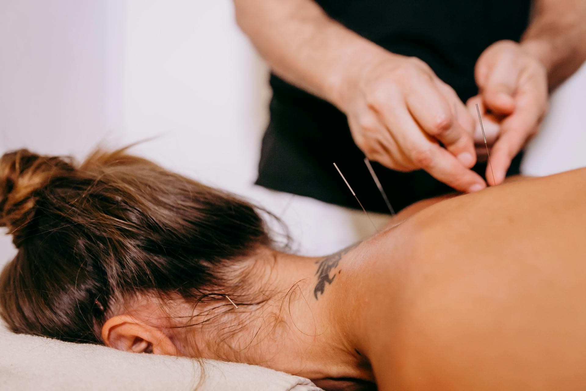 Electro-acupuncture treatment for chronic pain