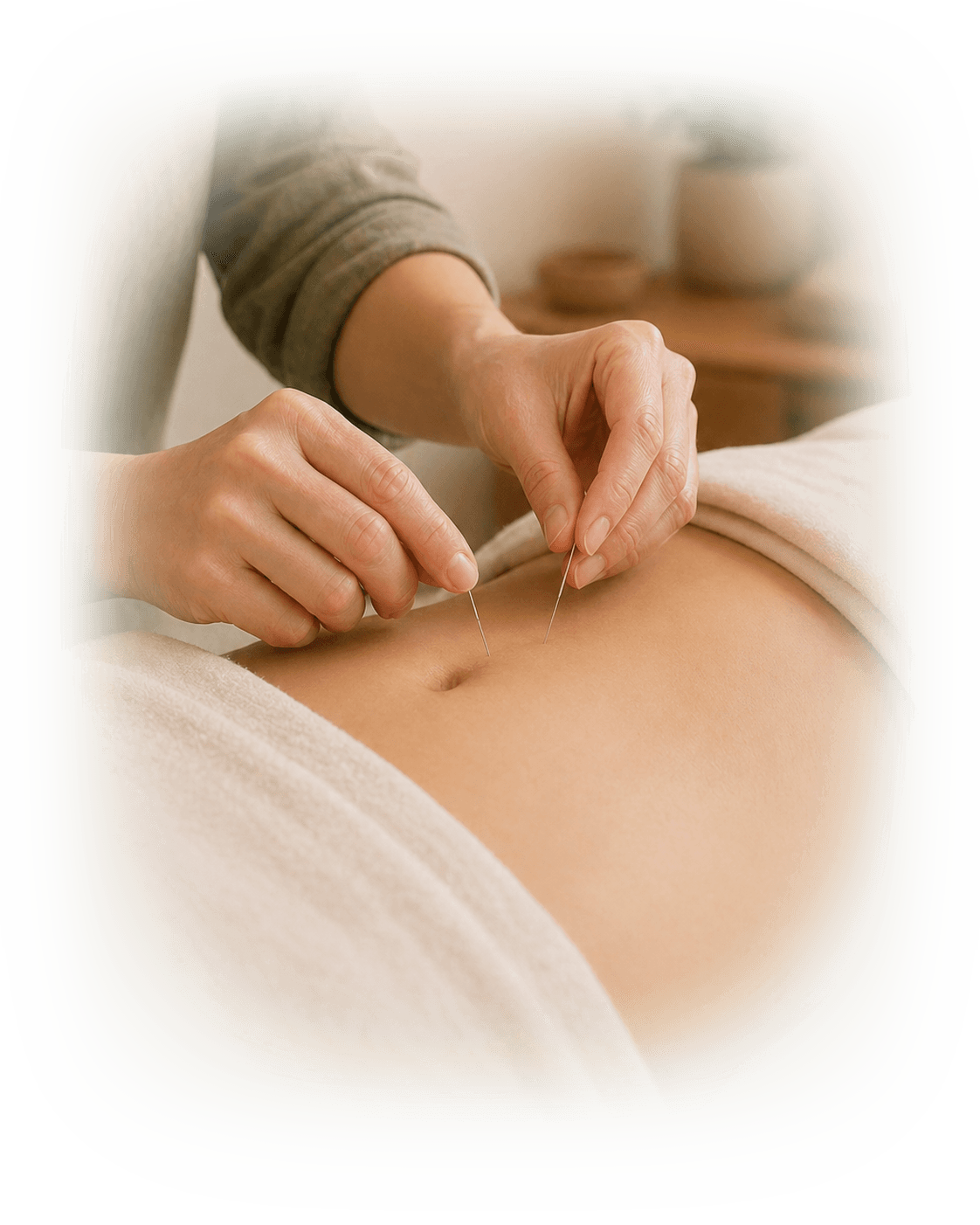 Practitioner placing acupuncture needles on the abdomen for digestive health