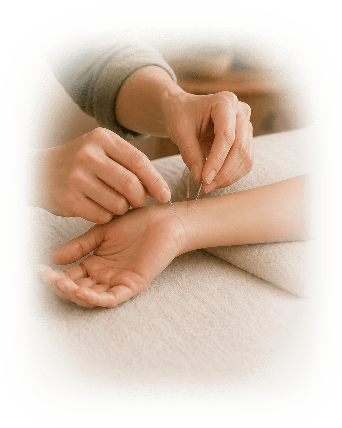 Practitioner placing acupuncture needles on the wrist for sleep support